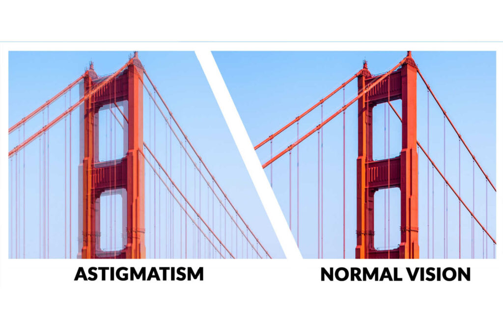 Golden Gate Bridge showing blurry vision of astigmatism on the left side and normal vision on the right.